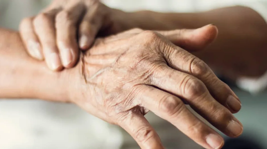 Parkinson hastalığı başlamadan teşhis edilebilecek